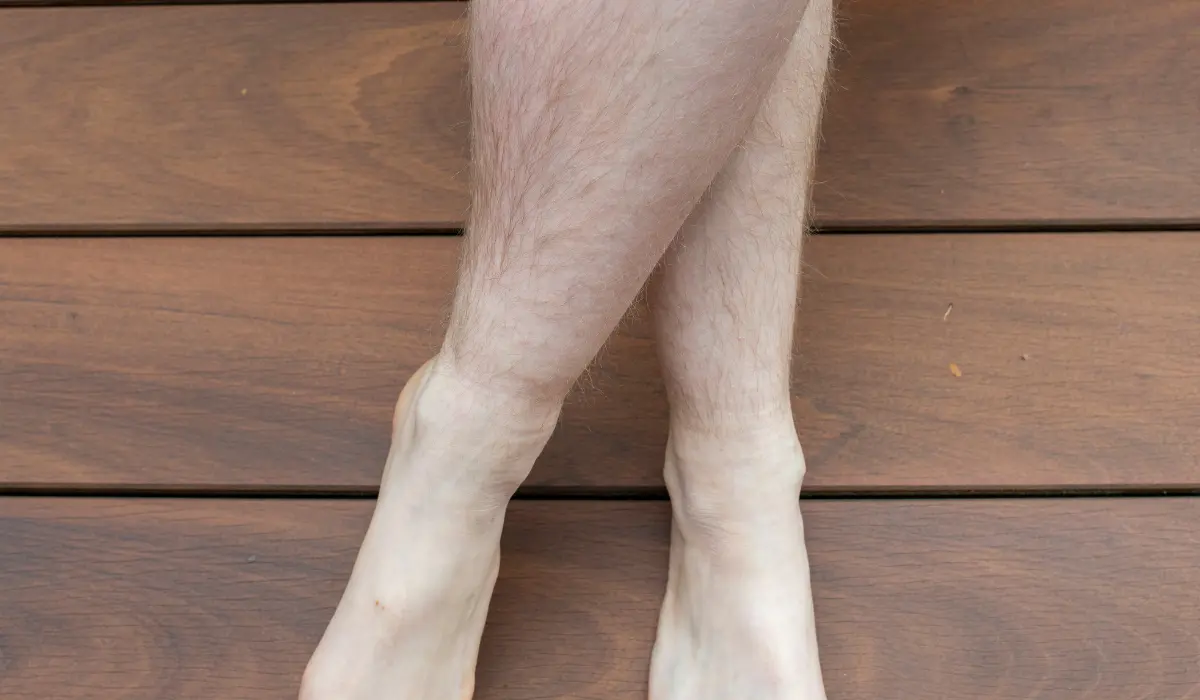 1 how to prevent hair loss while losing weight