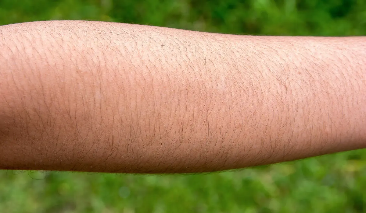 reduce unwanted hair growth 5 Benefits of Natural Remedies To Stop Hair Growth