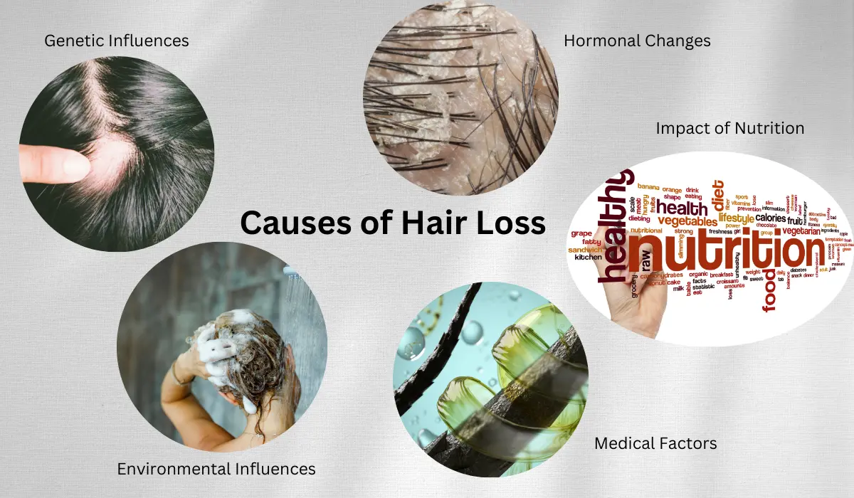 5 Causes of Hair Loss and Their Solutions 5 Causes of Hair Loss and Their Solutions